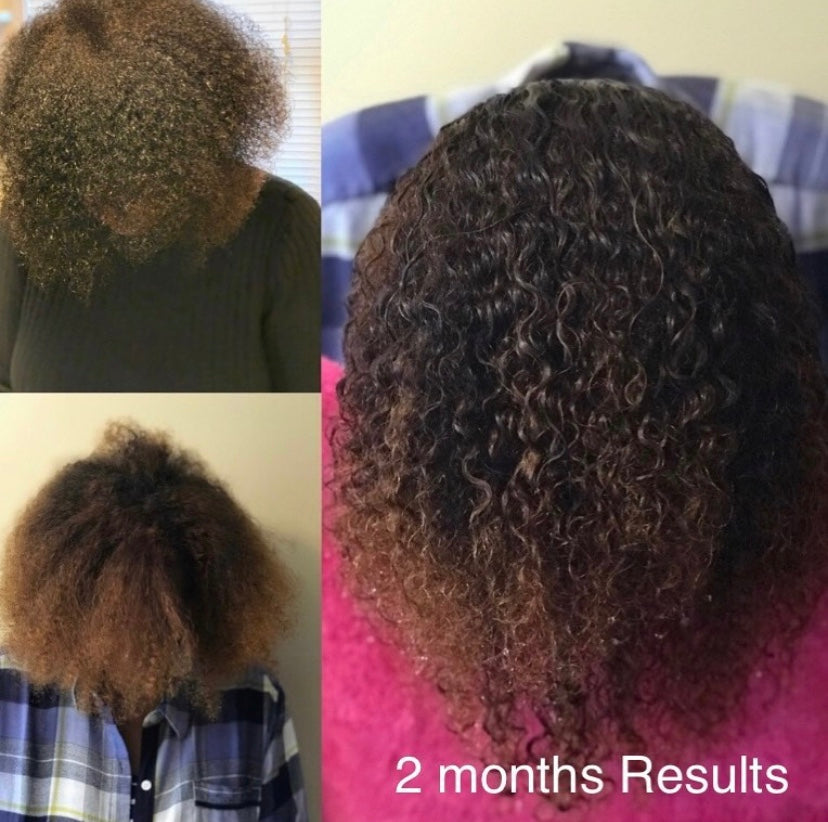 Hair Growth Oil