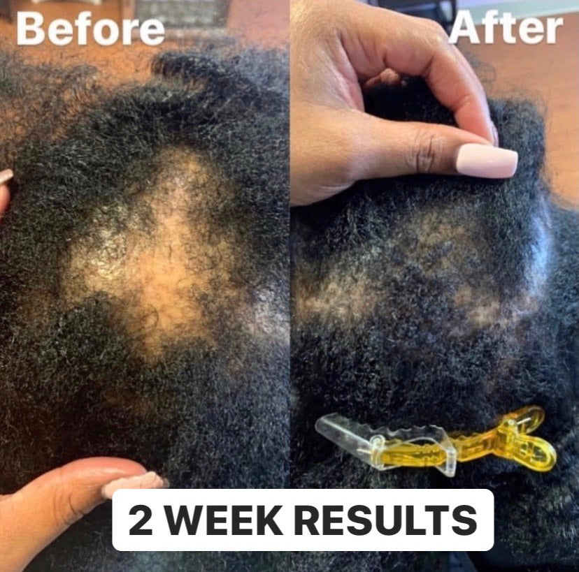 Hair Growth Oil