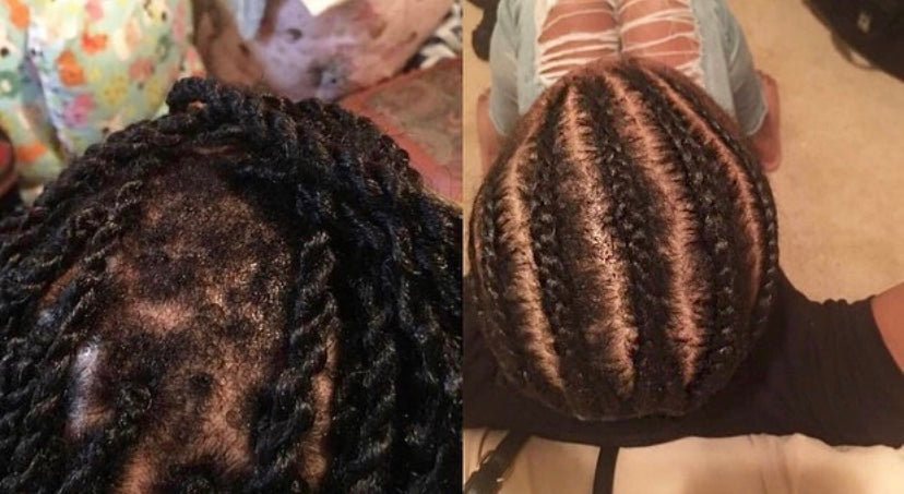 Hair Growth Oil