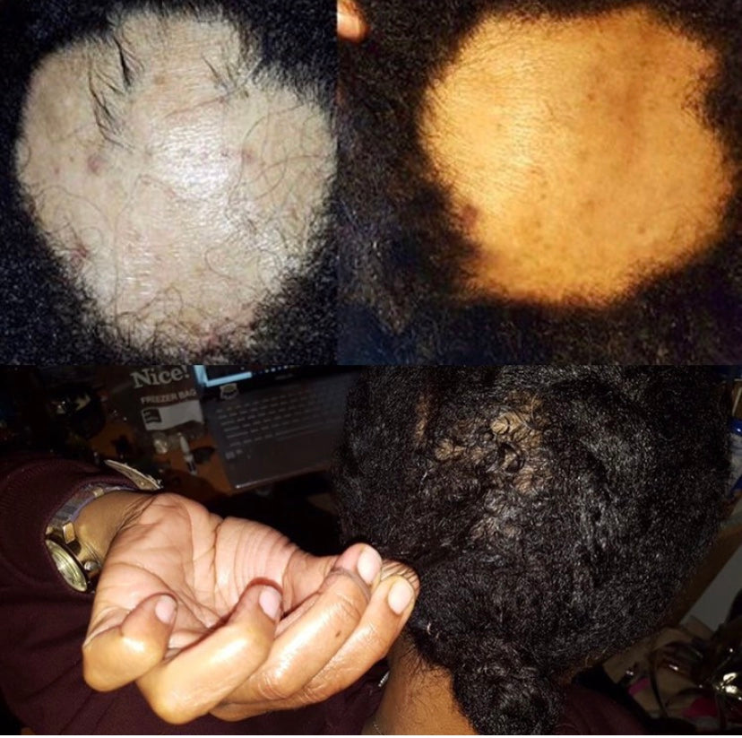 Hair Growth Oil