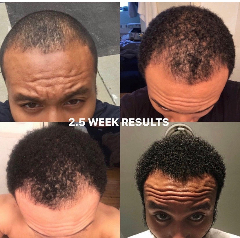 Hair Growth Oil